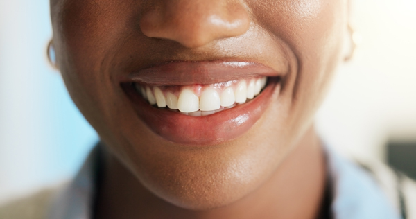 How Long Should My New Dental Crown Last?