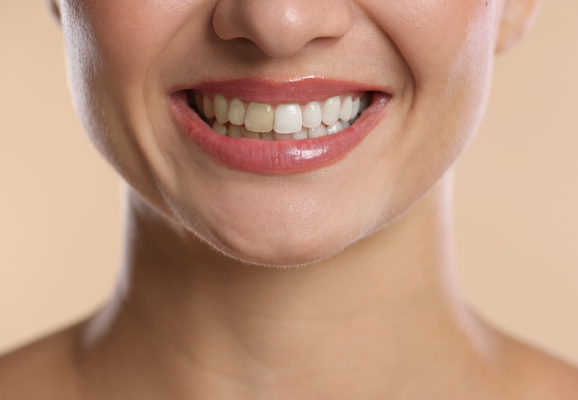Reinvent Your Teeth With A Smile Makeover